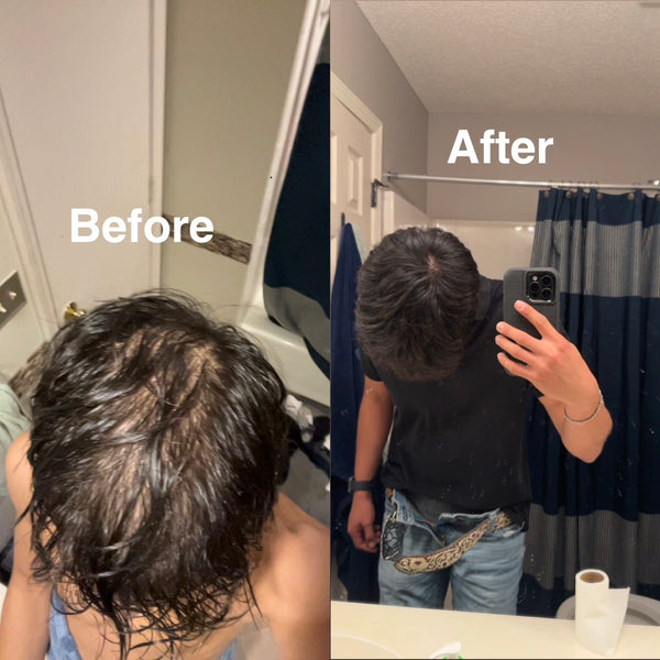 Rosemary Hair Growth Elixir